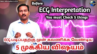 First step in ECG Interpretation in tamil  5 things must Observe before ECG interpretation [upl. by Cchaddie888]