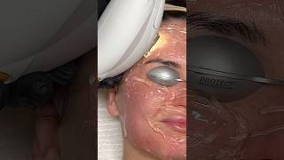 ASMR Laser Treatment [upl. by Madlen]