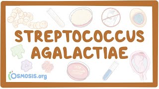 Streptococcus agalactiae group B strep  an Osmosis Preview [upl. by Naziaf]