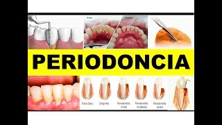 quotPERIODONCIAquot por la Dra Margot de los Rios 1 [upl. by Odrareg616]