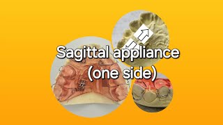 Fabrication process for Sagittal appliance [upl. by Alimrahs]