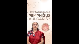 How to Diagnose Pemphigus Vulgaris [upl. by Ianteen]