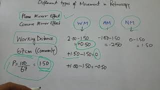 Different types of movement in Retinoscopy [upl. by Lerat]