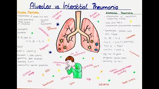 Alveolar vs Interstitial Pneumonia comparison [upl. by Thilda]