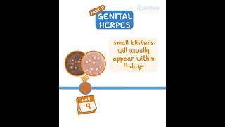 Genital Herpes pt 2 [upl. by Stanfield937]