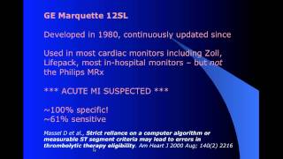 Managing STEMI Mimics in the Prehospital Environment part 13 [upl. by Peonir]