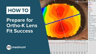 HowTo  Prepare for OrthoK lens fit success [upl. by Eissahc]