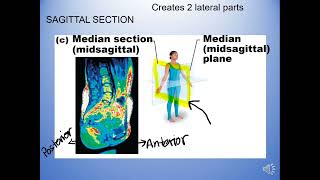 Anatomical Terms and Sections default [upl. by Eluk]