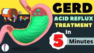 GERD Treatment  Acid Reflux Treatment  Heartburn Treatment  All You Need to Know [upl. by Ahseinad436]