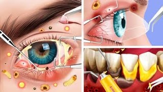 ASMR CARE ANIMATION COLLECTION  Blackhead  Sebum  Stye  Piercing  Eye [upl. by Otnicaj973]