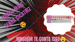 VLOG POMADA IRUXOL  colagenase e cloranfenicol [upl. by Laurinda]