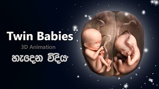 නිවුන් දරුවන් කොහොමද හැදෙන්නෙ 😨 Development of Twins in sinhala  twin babies  niwun daru upath [upl. by Reltuc]