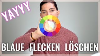 Blaue Flecken abdecken  weg schminken Tipps und Tricks [upl. by Oemac690]