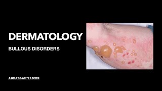 PEMPHIGUS VULGARIS  BULLOUS PEMPHIGOID  بالعربي [upl. by Ecnedac]