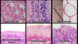 Identifying Epithelium  Review and Practice Questions [upl. by Hgielanna]