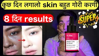 कुछ दिन में स्किन बहुत गोरी  Dr alies vitamin c serum  Dr alies vitamin c serum review  Dr alies [upl. by Ahsiekit]