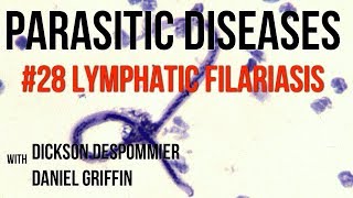 Parasitic Diseases Lectures 28 Lymphatic Filariasis [upl. by Kaliski189]