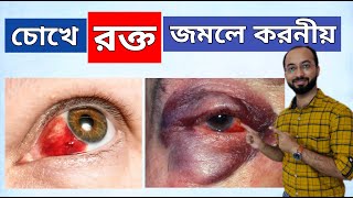 amasha treatment bangla  আমাশা রোগের ঘরোয়া চিকিৎসা [upl. by Leinad825]