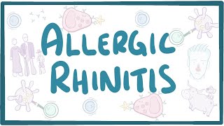 Allergic Rhinitis  causes symptoms diagnosis treatment pathology [upl. by Nolyat795]