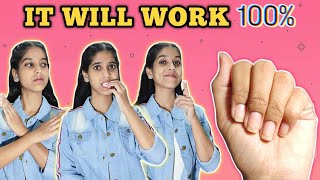 How to Stop Biting Your Nails Within 15 days [upl. by Richie]