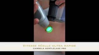 Epilation des jambes au laser [upl. by Nared946]