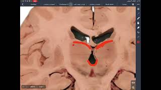 تشريح المحاضرة الثالثة thalamushypothalamuspineal gland [upl. by Einnaffit151]