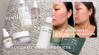 my holy grail korean skincare for calming acne amp healing my skin barrier  ANUA product review [upl. by Lombardi27]