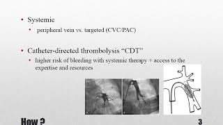 Thrombolytic therapy for pulmonary thromboembolism part 2 How [upl. by Adihahs]