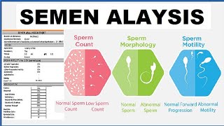 SEMEN ANALYSIS TEST IN HINDI SEMEN ANALYSIS TEST REPORT [upl. by Remington]