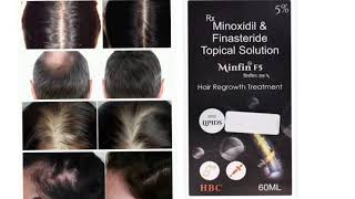 Minfin F5 Topical Solution Hair Regrowth Treatment Minoxidil amp Finasteride Topical Solution [upl. by Thacher]