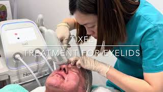 TIXEL  SKINCARE LASER CLINIC  POINT COOK MELBOURNE [upl. by Lraed]