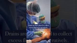 Brachioplasty Surgery with Dr Brian Pinsky [upl. by Olivia]