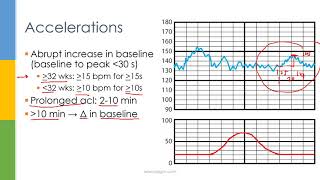 Learn OBGYN Fetal Heart Rate Monitoring  Nonstress Test [upl. by Nessej939]