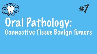 Oral Pathology  Connective Tissue Benign Tumors  INBDE ADAT [upl. by Cerallua]