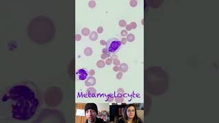 Metamyelocyte Morphological Characteristics [upl. by Gross534]