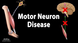 Motor Neuron Disease Animation [upl. by Thier]