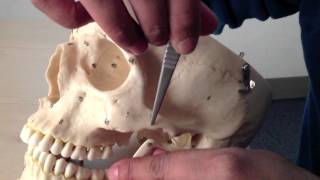 Skull Anatomy 2 of 5 Anterior View and Mandible  Head and Neck Anatomy 101 [upl. by Terris]