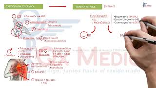 Cardiología  01 Cardiopatía isquémica [upl. by Francie592]