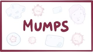 Mumps  symptoms diagnosis treatment pathology [upl. by Romie]