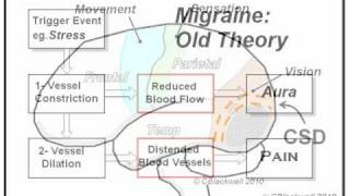 Migraine 1 The Experience [upl. by Stew]