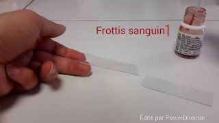 Protocole frottis sanguin [upl. by Ydnis]