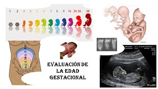 EVALUACIÓN DE LA EDAD GESTACIONAL [upl. by Micki]