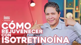 COMO REJUVENECER TU PIEL CON ISOTRETINOINA [upl. by Jonathan530]