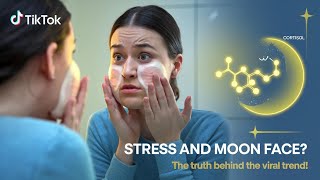 Can Stress Really Cause Moon Face Experts Explain the TikTok Trend [upl. by Odetta]