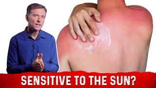 Can You Be Allergic to the Sun – DrBerg on Sun Allergy and Niacin Deficiency [upl. by Wallach]