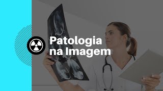 PATOLOGIA NA IMAGEM  PATOLOGIAS DO ABDOME [upl. by Aittam]