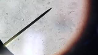 Bacillus Cereus Motility [upl. by Cad]