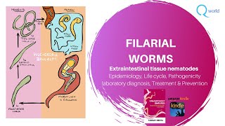 Filarial worms Wuchereria bancrofti Brugia malayi Mansonia Loa loa Onchocerca volvulus ampmore [upl. by Malha]