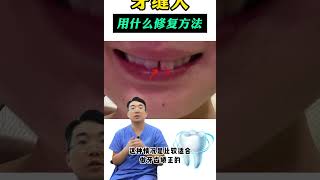 牙缝大案例分享，适合做什么修复方法？ [upl. by Petrie]