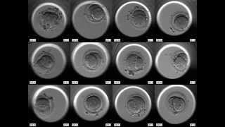 Embryoscope  Embryonen Entwicklung online [upl. by Amii]